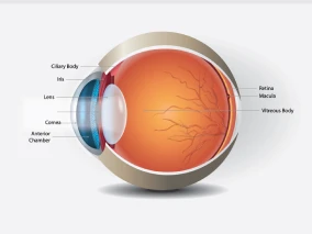 Trifocal Cataract Surgery