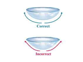 Trifocal Cataract Surgery