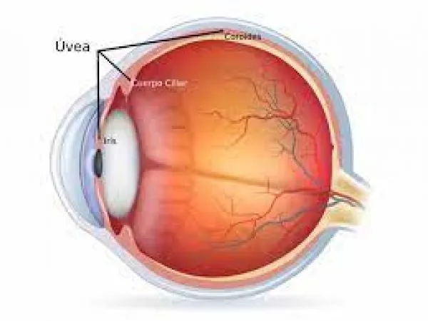 Uveitis Treatment Structure Uveitis Treatment